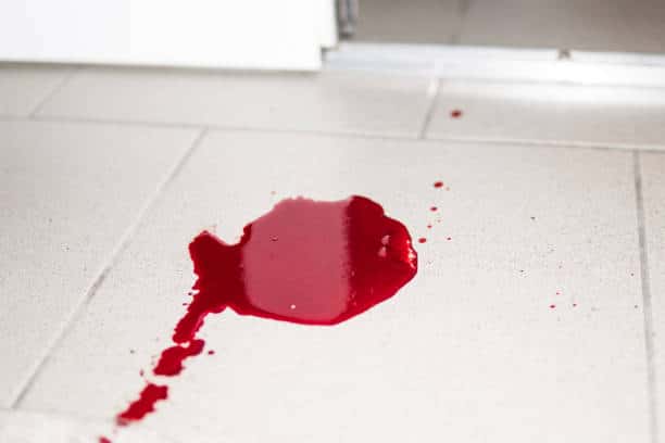 Scopri di più sull'articolo Trattamento cotto antimacchia
